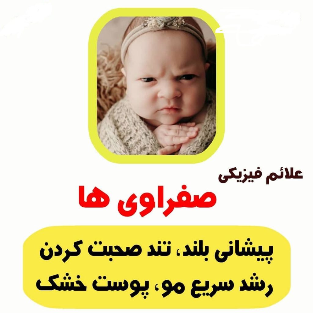 علایم صفراوی ها